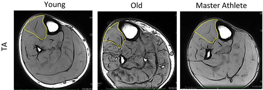 MRI-images-of-the-lower-leg-of-Young-Old-and-Master-Athlete-participants-The-tibialis